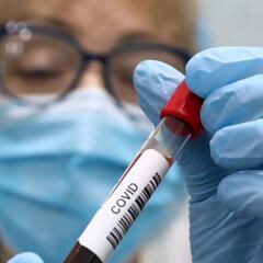 Coronavirus Colombia: ¿cómo ha aumentado la capacidad de UCIs y pruebas de COVID-19?