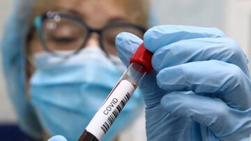 Coronavirus Colombia: ¿cómo ha aumentado la capacidad de UCIs y pruebas de COVID-19?