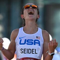 Seidel: "Lucho contra el TOC y con los trastornos alimentarios"