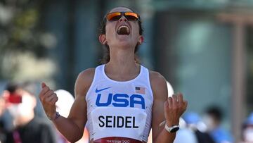 Seidel: "Lucho contra el TOC y con los trastornos alimentarios"