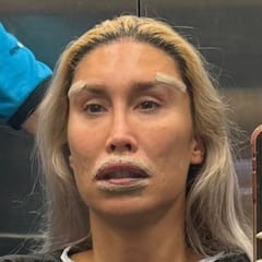 El impactante cambio físico de ‘La Pelopony’ tras su enésima cirugía