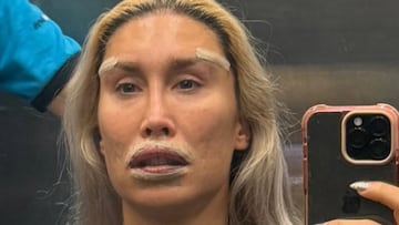 El impactante cambio físico de ‘La Pelopony’ tras su enésima cirugía