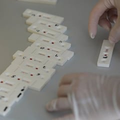 Madrid utilizará test rápidos que dan resultados en 15 minutos