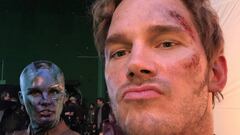 La amarga luna de miel de Chris Pratt: completamente quemado.