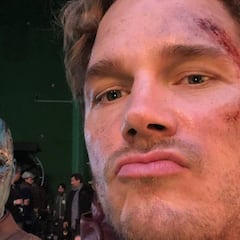 La amarga luna de miel de Chris Pratt: completamente quemado