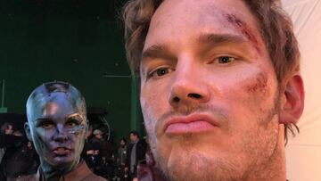 La amarga luna de miel de Chris Pratt: completamente quemado.