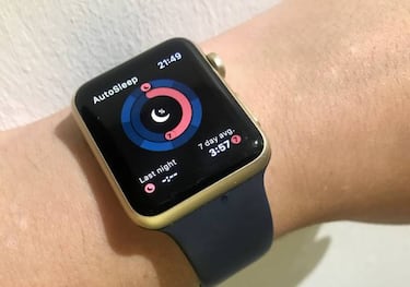 Sensor de nivel de potasio, la nueva característica del Apple Watch