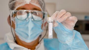 Valparaiso, 18 de febrero de 2022.
Se realiza una toma de muestra del examen PCR en la plaza O’Higgins.
Andres Pina/Aton Chile