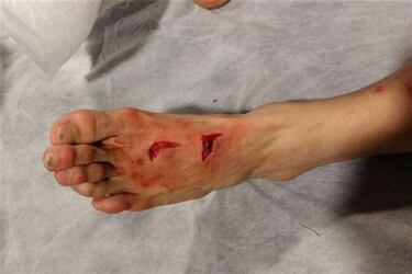 Jugador de Juventus destrozó el pie de Héctor Herrera