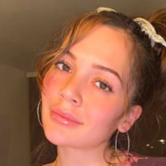 Lina Tejeiro muestra cómo quedó tras cirugía de biopolímeros