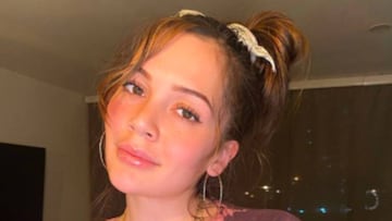 Lina Tejeiro muestra cómo quedó tras cirugía de biopolímeros