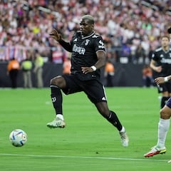 Pogba suffers first scare with Juve