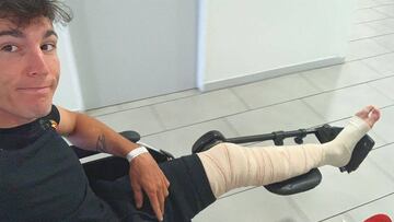 Aleix confirma su lesión de tibia y fémur.