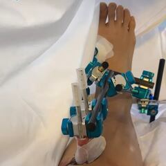 Confirmada una fea fractura de tibia y peroné de Rins