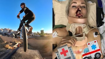 Caroline Buchanan rueda con su bici de BMX y mostr&oacute; su heridas desde el hospital tras ser atropellada por un coche.