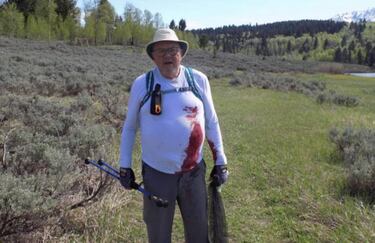 Un aventurero de 73 a?os sobrevive a un ataque de oso grizzly