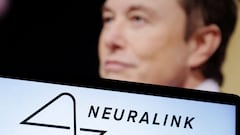 Neuralink will begin recruiting patients for the first human trials of its brain-computer interface implant, but questions persist about safety.