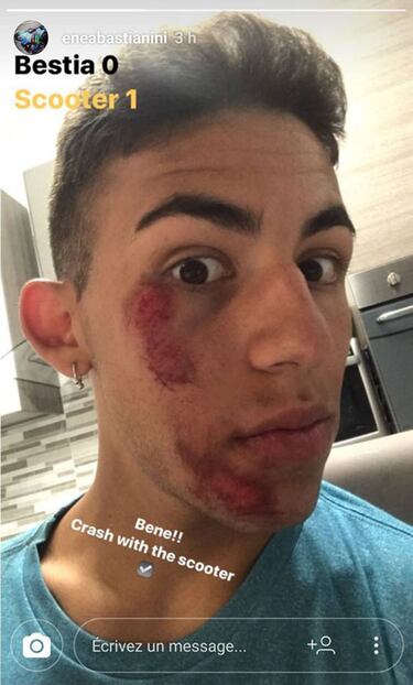 Así tiene la cara Bastianini tras accidentarse con una Scooter