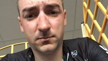 Elia Viviani mostr&oacute; en su cuenta de Twitter las heridas sufridas tras ser arrollado por una moto en la Par&iacute;s-Roubaix.