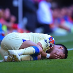 Los jugadores lesionados del América en el Apertura 2023