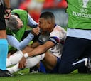 Las imágenes del impactante golpe en la nariz de Mbappé