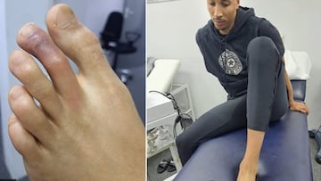 As¨ª est¨¢ el dedo de Exum: ¡°En el Madrid dec¨ªan que era falso¡±