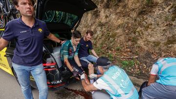 LAGOS DE COVADONGA (ASTURIAS),, 03/09/2024.- El belga Wout van Aert (Visma-Lease bike), líder de la regularidad y la Montaña, ha abandonado este martes la 79 edición Vuelta a España en tras sufrir una caída en la decimosexta etapa de la carrera, con final en los Lagos de Covadonga con 181 kilómetros de recorrido. EFE/Javier Lizón
