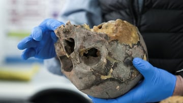12,000-year-old skeleton in Vietnam shows signs of violent death and links to early hunter-gatherers, challenging theories on East Asian ancestry.
