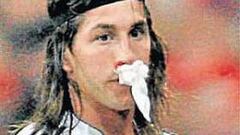 Sergio Ramos, operado ayer del tabique nasal