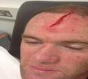 Wayne Rooney está de baja por un corte profundo en la cabeza