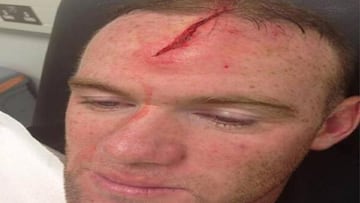 Wayne Rooney está de baja por un corte profundo en la cabeza