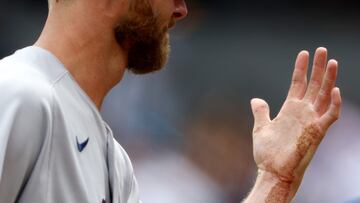 Boston Red Sox ace pitcher Chris Sale broke a finger during their game with the New York Yankees after a line drive off the bat ricocheted on to his hand.