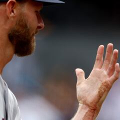 Is Boston Red Sox pitcher Chris Sale out for the rest of the season?