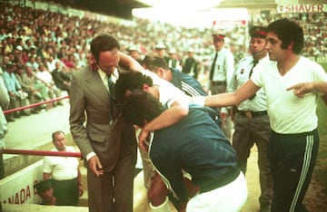 El 8 de junio de 1974 se enfrentaban en el Estadio de los Carmenes el Granada y el Real Madrid  en un partido de Copa. En el minuto 16 Amancio atravesó la línea prohibida con el balón controlado, colándose rápidamente hacia el campo contrario. Fernández le salió al encuentro, de frente, levantó la pierna y descargó los tacos con toda su fuerza brutal sobre el muslo derecho del atacante, mientras dejaba pasar mansamente el balón, que rodaba por el suelo. Amancio cayó hecho un grito y su muslo se hinchó inmediatamente. Tenía partido en dos el cuádriceps, el músculo más fuerte del cuerpo.