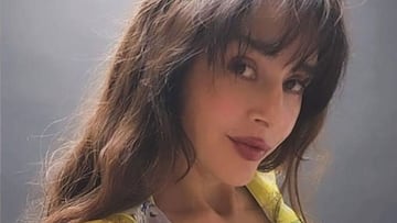 Quién Dorismar, la modelo que apareció con el rostro desfigurado, tras cirugía estética