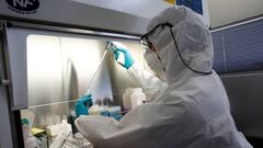 Coronavirus Perú: ¿por qué es importante que Diresa Cusco produzca Ivermectina?