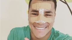Jeison Murillo fue operado de la nariz con éxito