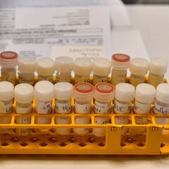 La 'cepa asiática' del coronavirus que también entró en España