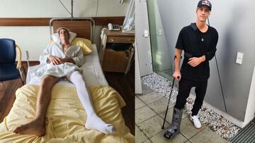 El piloto de MTB Fabio Wibmer en el hospital a la izquierda y ya saliendo con el hombro y el tobillo fracturados, a la derecha. 