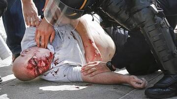 Los dos heridos ingleses en Marsella regresan "graves"