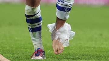 Take Kubo tuvo que ponerse hielo en el tobillo afectado. / JAVI COLMENERO