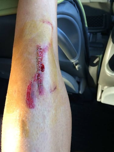 Checa quiere jugar el sábado pese a su herida de guerra