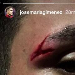 Giménez muestra la tremenda brecha con la que jugó