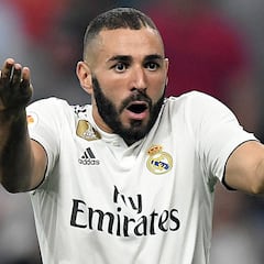 La extraña lesión de Benzema