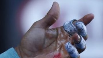 Aspecto de la mano izquierda de Nadal durante el partido ante Dimitrov.
