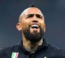 Arturo Vidal se quedó fuera del clásico ante la Juventus