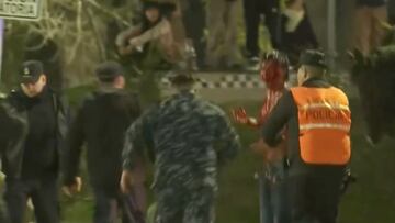 Sale a la luz otra secuencia impactante de un hincha de la U en Avellaneda: horror y pánico