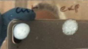 Un equipo español investiga un test rápido de 30 segundos