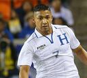 Emilio Izagurre es duda para jugar con Honduras ante Ecuador