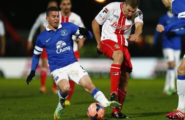 El jugador del Evertonc se rompi¨® la pierna en este lance del partido contra el Stevenage en la FA Cup en 2014.